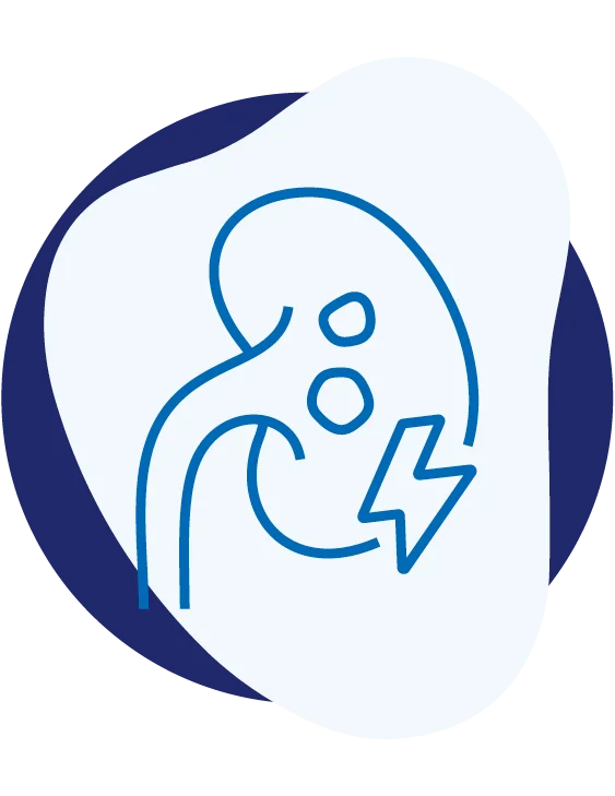 urocentrumwest-professor-dr-burkhard-ubrig-urologe-leistungen-behandlung-von-steinleiden